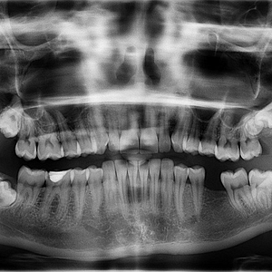 x-ray-961977_1280